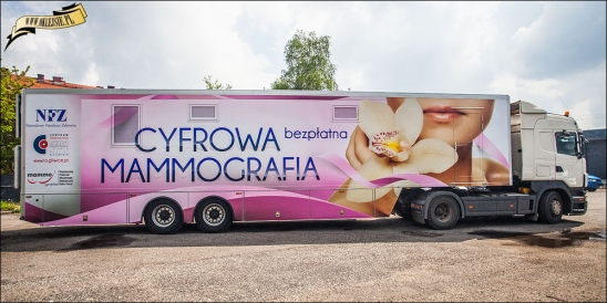 BEZPŁATNA CYFROWA MAMMOGRAFIA 